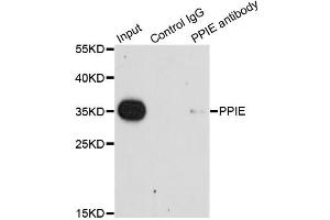 Immunoprecipitation analysis of 200 μg extracts of HeLa cells using 1 μg PPIE antibody (ABIN5975469).