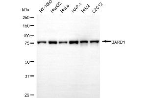 Western blotting analysis using BARD1 antibody (ABIN7797786).