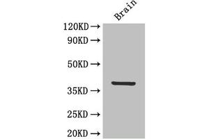 Western Blot Positive WB detected in: Mouse brain tissue All lanes: IL12B antibody at 4 μg/mL Secondary Goat polyclonal to rabbit IgG at 1/50000 dilution Predicted band size: 38 kDa Observed band size: 38 kDa (IL12B Antikörper  (AA 23-328))