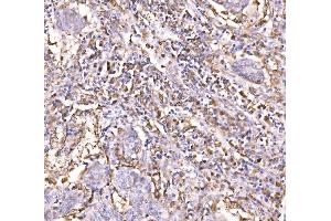 IHC analysis of Epac1/RAPGEF3 using anti-Epac1/RAPGEF3 antibody (ABIN7601858). (RAPGEF3 Antikörper  (AA 49-881))