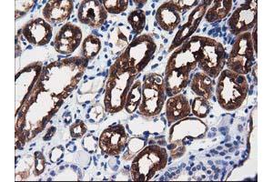 Immunohistochemical staining of paraffin-embedded Human liver tissue using anti-ALDH1L1 mouse monoclonal antibody. (ALDH1L1 Antikörper)