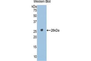 Western blot analysis of the recombinant protein. (A1BG Antikörper  (AA 220-415))