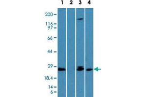Western blot analysis of TICAM2 in the (Lane 1) absence and (Lane 2) presence of immunizing peptide in human lung, (Lane 3) mouse lung and (Lane 4) rat lung lysate using TICAM2 polyclonal antibody  at 1 ug/mL . (TICAM2 Antikörper  (AA 87-103))