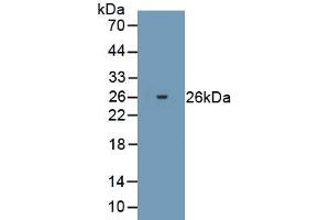 Detection of Recombinant PRDX2, Human using Polyclonal Antibody to Peroxiredoxin 2 (PRDX2) (Peroxiredoxin 2 Antikörper  (AA 2-198))