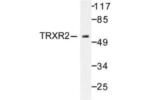 Image no. 1 for anti-Thioredoxin Reductase 2 (TXNRD2) antibody (ABIN271967) (TXNRD2 Antikörper)