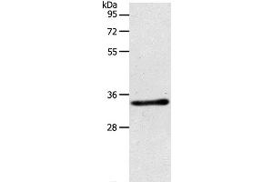 Western Blot analysis of Mouse kidney tissue using ACY3 Polyclonal Antibody at dilution of 1:500 (Aminoacylase 3 Antikörper)