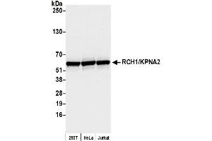 Western Blotting (WB) image for anti-Importin Subunit alpha-1 (KPNA2) (C-Term) antibody (ABIN7453571) (Importin Subunit alpha-1 (KPNA2) (C-Term) Antikörper)