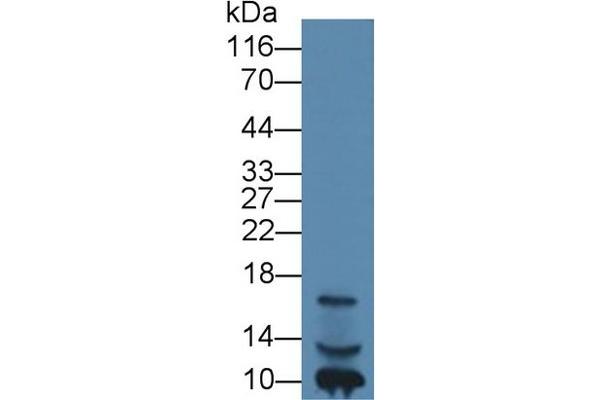 IGF1 Antikörper  (AA 49-118)
