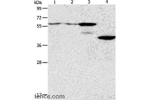 Western blot analysis of A375 and A172 cell, mouse pancreas tissue, human liver cancer tissue, using PGBD2 Polyclonal Antibody at dilution of 1:550 (PGBD2 Antikörper)