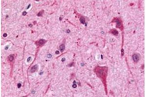 Immunohistochemical (Formalin/PFA-fixed paraffin-embedded sections) staining in human brain, neurons and glia with GPR75 polyclonal antibody . (GPR75 Antikörper  (C-Term))