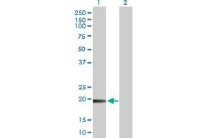 Western Blot analysis of TMEM134 expression in transfected 293T cell line by TMEM134 MaxPab polyclonal antibody. (TMEM134 Antikörper  (AA 1-195))