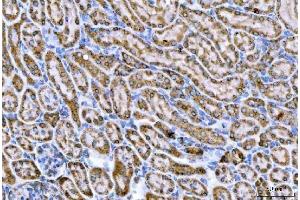 IHC analysis of CPT1A using anti-CPT1A antibody (ABIN7599853). (CPT1A Antikörper  (AA 122-556))