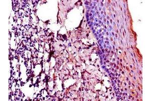 Immunohistochemistry of paraffin-embedded human tonsil tissue using ABIN7172803 at dilution of 1:100 (TACC3 Antikörper  (AA 133-268))