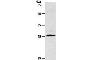 Western Blot analysis of Mouse liver tissue using NQO2 Polyclonal Antibody at dilution of 1:1200 (NQO2 Antikörper)
