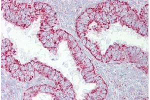 Anti-PDGFB antibody IHC staining of human uterus. (PDGF-BB Homodimer (N-Term) Antikörper)