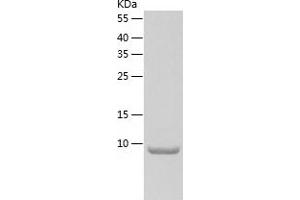 Betacellulin (BTC) (AA 32-111) protein (His-IF2DI Tag)