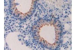 Immunohistochemistry (IHC) image for anti-Chemokine (C-C Motif) Ligand 4 (CCL4) (AA 24-92) antibody (ABIN7430945)