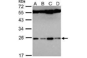 WB Image Sample (30 ug of whole cell lysate) A: Hela B: Hep G2 , C: Molt-4 , D: Raji 12% SDS PAGE antibody diluted at 1:5000 (FAM9B Antikörper)