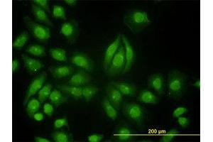 Image no. 3 for anti-Tyrosine Kinase 2 (TYK2) (AA 276-375) antibody (ABIN598992) (TYK2 Antikörper  (AA 276-375))