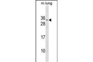 Western blot analysis in mouse lung tissue lysates (35ug/lane). (RBM7 Antikörper  (C-Term))