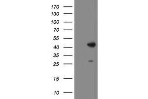 Western Blotting (WB) image for anti-Dihydrolipoamide Branched Chain Transacylase E2 (DBT) antibody (ABIN1497771)