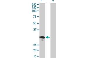 Western Blot analysis of RABL2B expression in transfected 293T cell line by RABL2B monoclonal antibody (M01), clone 1B10. (RABL2B Antikörper  (AA 1-229))
