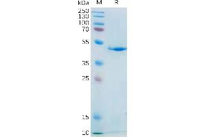 SDS-PAGE (SDS) image for Interleukin 21 (IL21) (AA 30-162) protein (mFc Tag) (ABIN7092720)