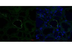 Mouse kidney (AQP2 Antikörper  (Middle Region))