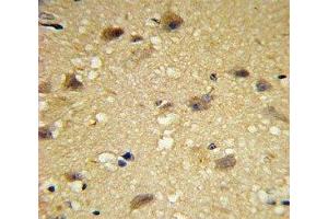 IHC analysis of FFPE human brain tissue with CCL2 antibody (CCL2 Antikörper  (AA 62-89))