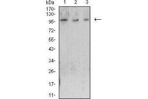 Western blot analysis using CD223 mouse mAb against Raji (1), Ramos (2), and MOLT4 (3) cell lysate. (LAG3 Antikörper)
