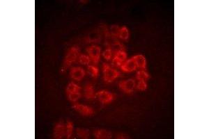 Immunofluorescent analysis of BOC staining in SW480 cells. (BOC Antikörper)