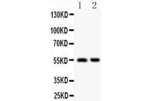 Anti-HDAC2 antibody,  Western blotting All lanes: Anti HDAC2 () at 0.