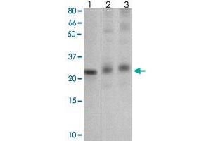 The tissue/cell lysate derived from mouse liver (Lane 1), mouse muscle (Lane 2) and MCF-7 (Lane 3) were immunoprobed by SOCS1 polyclonal antibody  at 1 : 500. (SOCS1 Antikörper  (C-Term))