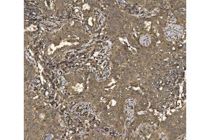 IHC analysis of EIF5 using anti-EIF5 antibody (ABIN7599722).