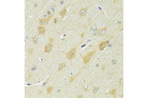 Immunohistochemistry of paraffin-embedded rat brain using SLC25A1 antibody. (Slc25a1 Antikörper)