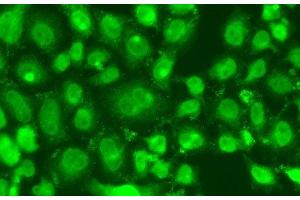 Immunofluorescence analysis of A549 cells using TSEN2 Polyclonal Antibody (TSEN2 Antikörper)