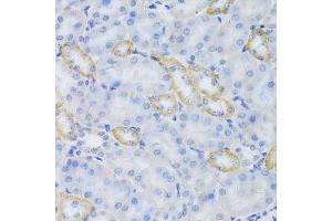 Immunohistochemistry of paraffin-embedded mouse kidney using MRPS30 Antibody. (MRPS30 Antikörper  (AA 190-439))