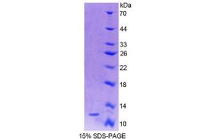 Image no. 1 for S100 Calcium Binding Protein A4 (S100A4) (AA 2-101) protein (His tag) (ABIN1080721)