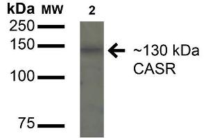 Western blot analysis of Rat Kidney cell lysates showing detection of 130kDa Calcium Sensing Receptor protein using Rabbit Anti-Calcium Sensing Receptor Polyclonal Antibody .