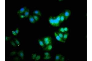 Immunofluorescence staining of HepG2 cells with ABIN7150368 at 1:333, counter-stained with DAPI.
