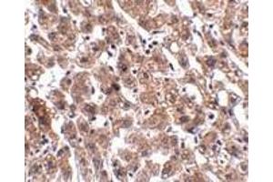 Immunohistochemistry of HAAO in human liver tissue with HAAO antibody at 2. (HAAO Antikörper  (N-Term))