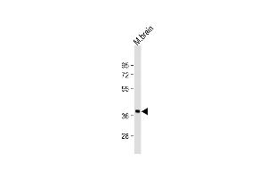 Anti-RASSF2 Antibody (N-Term)at 1:2000 dilution + mouse brain lysates Lysates/proteins at 20 μg per lane. (RASSF2 Antikörper  (AA 64-98))