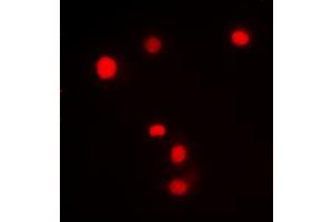 Immunofluorescent analysis of SP1 (pT453) staining in Jurkat cells. (SP1 Antikörper  (pSer453))
