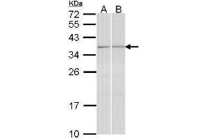WB Image Sample (30 ug of whole cell lysate) A: A431 , B: Hela 12% SDS PAGE antibody diluted at 1:1000 (TGIF2 Antikörper  (C-Term))
