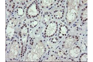 Image no. 6 for anti-SEC14 and Spectrin Domains 1 (SESTD1) antibody (ABIN1501066)