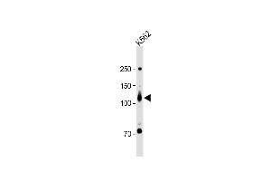 All lanes : Anti-ROR2 Antibody (N-term) at 1:1000 dilution + K562 whole cell lysate Lysates/proteins at 20 μg per lane. (ROR2 Antikörper  (N-Term))