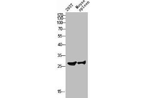 RPS4Y1 Antikörper  (C-Term)