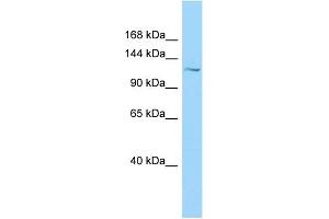 WB Suggested Anti-PKD1L1 Antibody Titration: 1. (PKD1L1 Antikörper  (N-Term))