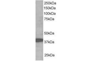 Image no. 1 for anti-Ring Finger Protein 39 (RNF39) (C-Term) antibody (ABIN374298) (RNF39 Antikörper  (C-Term))
