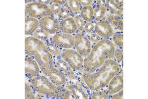 Immunohistochemistry of paraffin-embedded mouse kidney using NLRC4 antibody at dilution of 1:100 (x400 lens). (NLRC4 Antikörper)